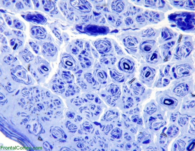 Toluidine staining of resin or plastic embedded peripheral nerve.